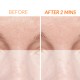 Kate Somerville ExfoliKate® Intensive Pore Exfoliating Treatment 7,5ml