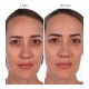 U BEAUTY Resurfacing Compound 10ml
