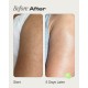 Topicals Slather Exfoliating Body Serum with Retinol and AHAs 50mL